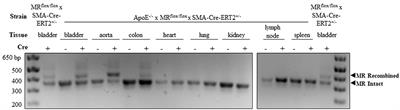 No Significant Role for Smooth Muscle Cell Mineralocorticoid Receptors in Atherosclerosis in the Apolipoprotein-E Knockout Mouse Model